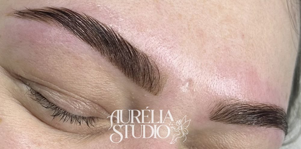 Brows after the brow lift