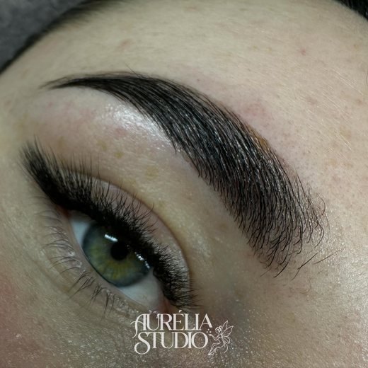 Brow lift done at the studio